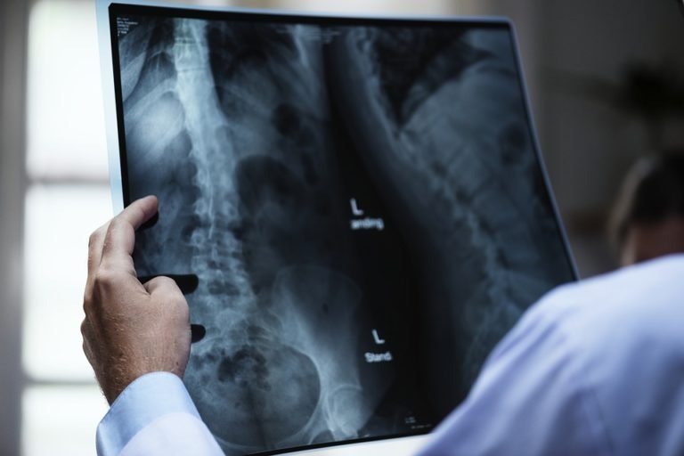 Read more about the article Nevis’ Junior Health Minister officially commissions new X-Ray equipment  at Alexandra Hospital