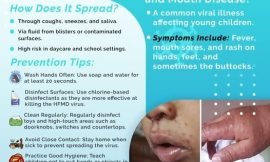 Ministry of Health-St. Kitts announces HFMD outbreak