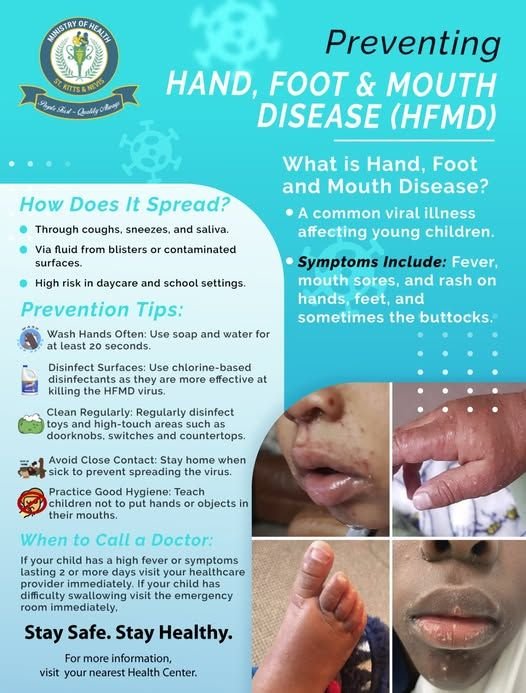 Read more about the article Ministry of Health-St. Kitts announces HFMD outbreak