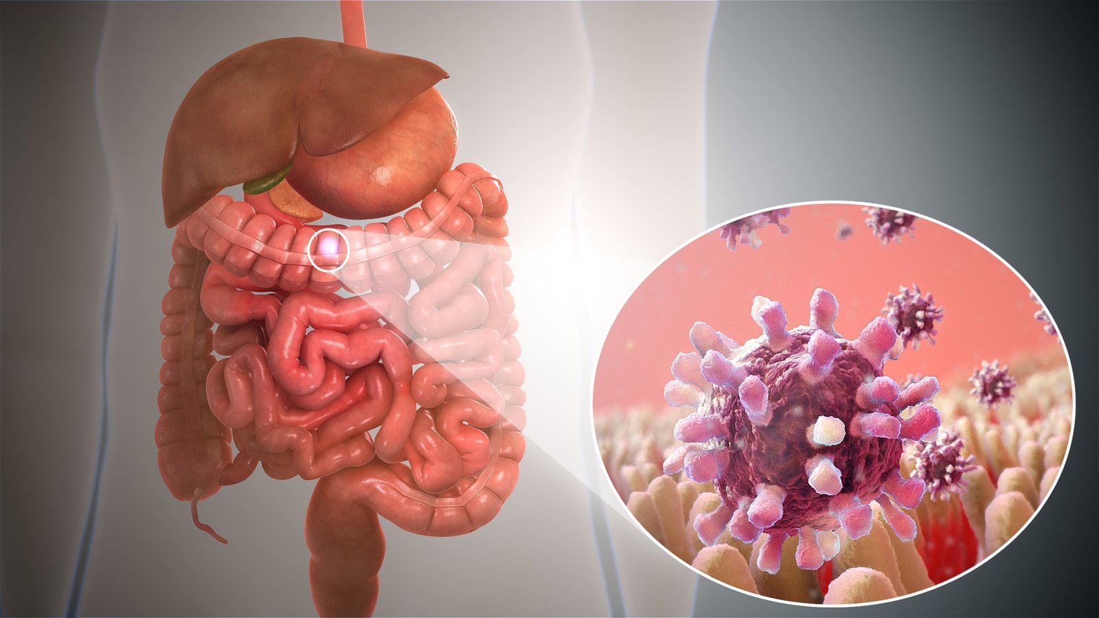 You are currently viewing Ministry of Health urges the public to be aware of the Symptoms of Gastroenteritis